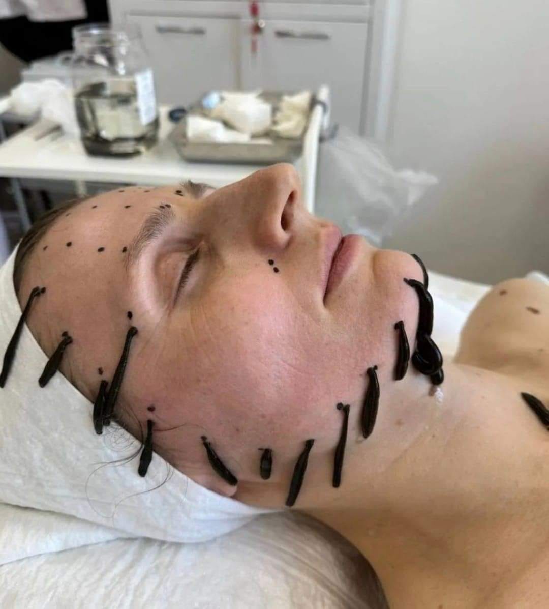 QUIROPRÁCTICO Photo